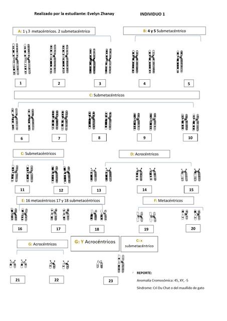 Cariotipos de 5 Individuos