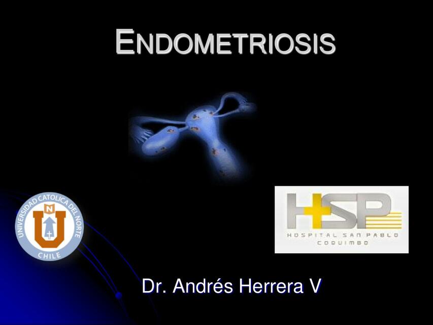 Endometriosis 