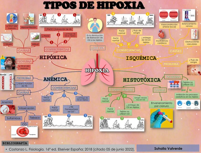 Tipos de Hipoxia