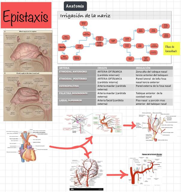 Epistaxis