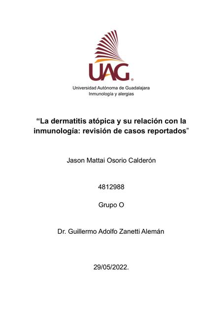 La dermatitis atópica y su relación con lainmunología: revisión de casos reportados