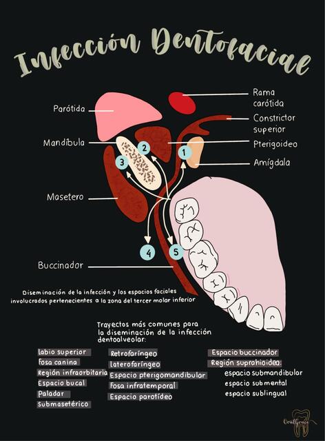 Infección Dentofacial