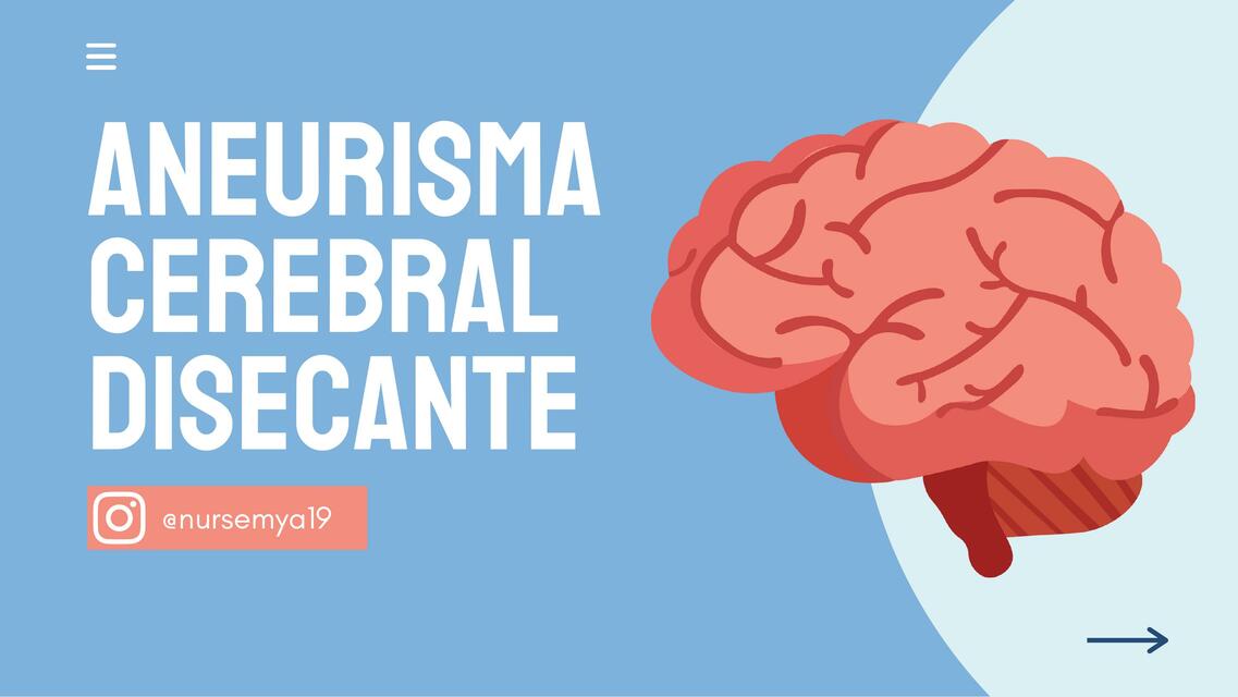 Aneurisma Cerebral Disecante