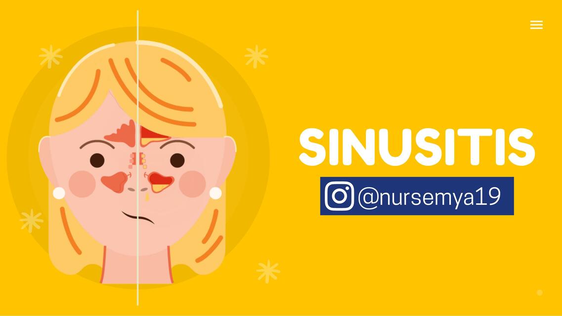 Sinusitis Crónica y Aguda