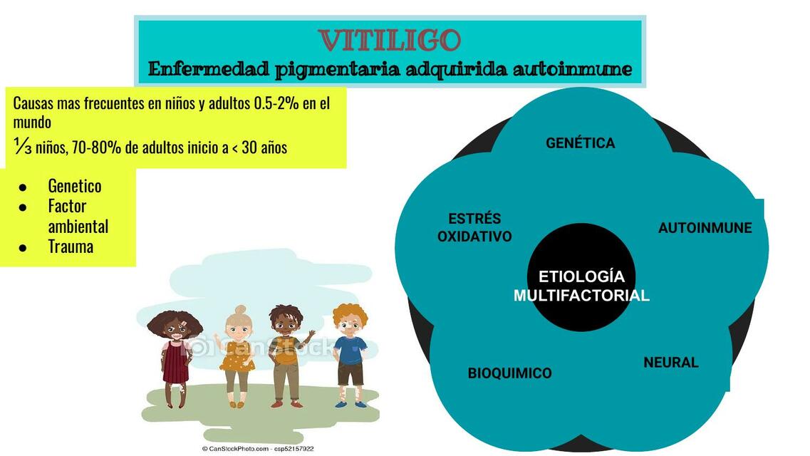 Vitiligo Melasma y Pitiriasis Alba