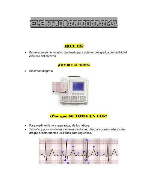 Electrocardiograma