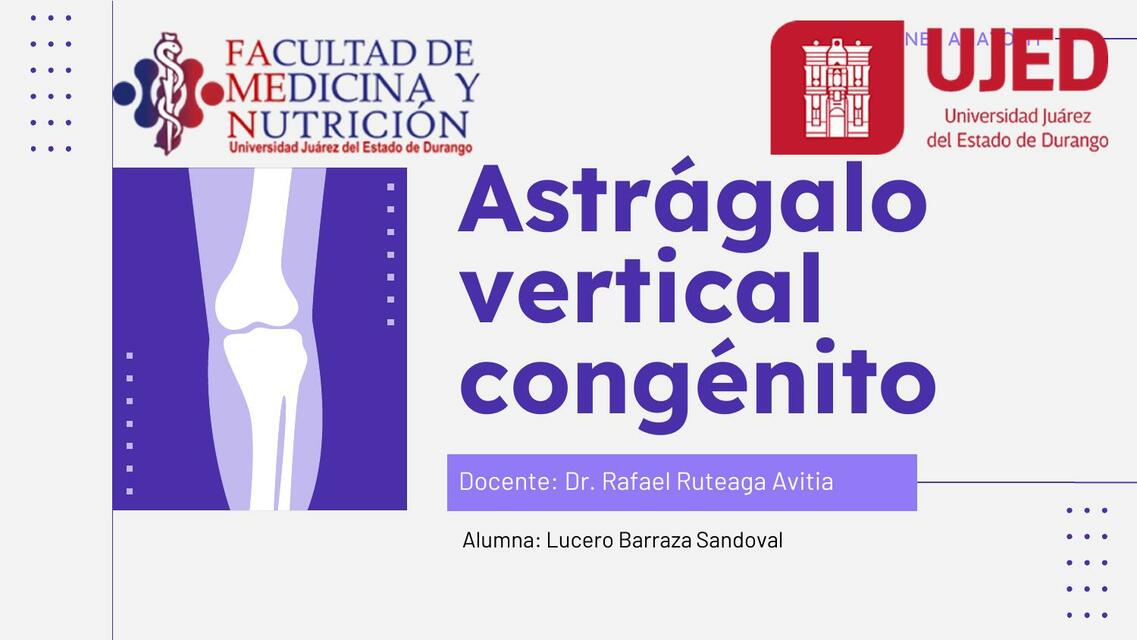 Astrágalo Vertical Congénito