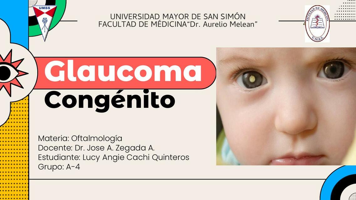 Glaucoma Congénito 