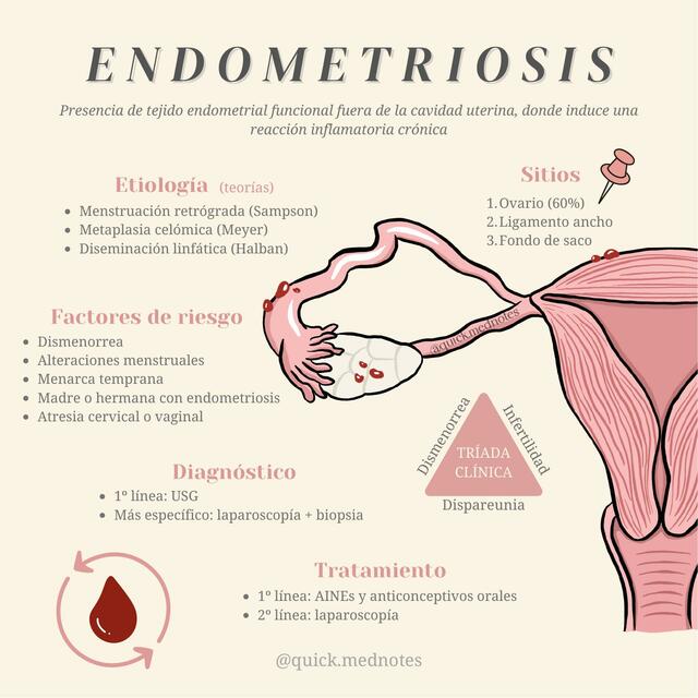 Endometriosis