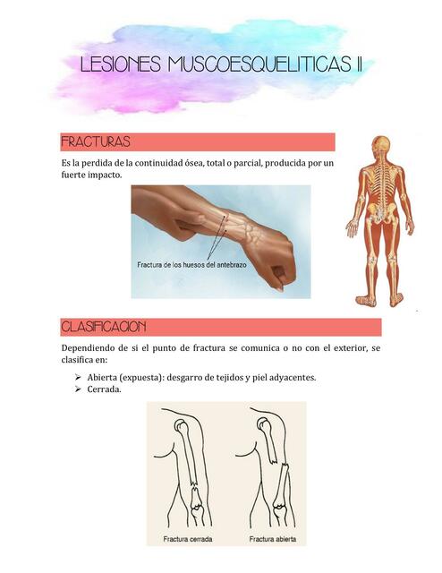 Resúmenes de Lesiones musculoesqueléticas | Descarga apuntes de ...