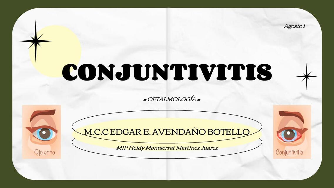 Conjuntivitis 