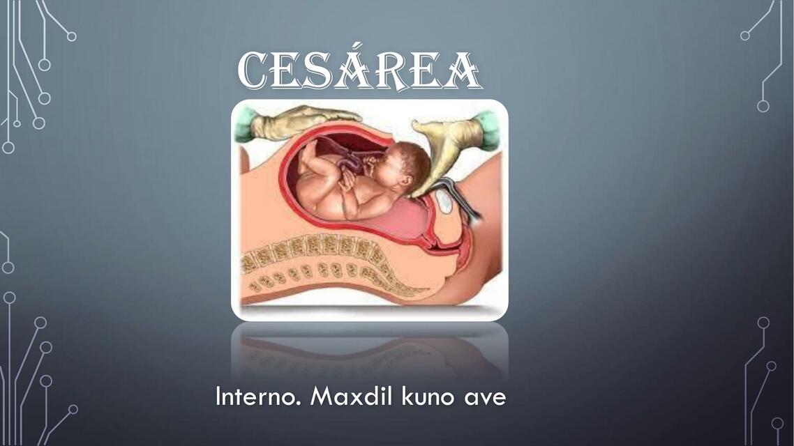 Cesárea