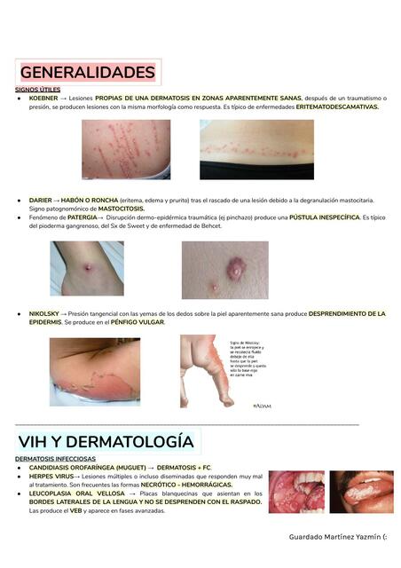 Generalidades de Dermatología