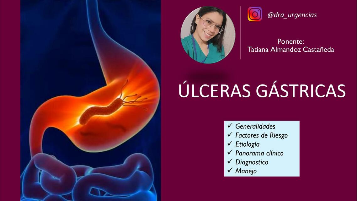 Úlceras gástricas 