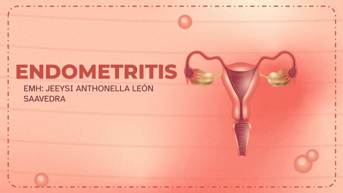 Endometritis 