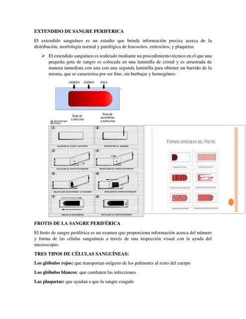 Extendido periférico