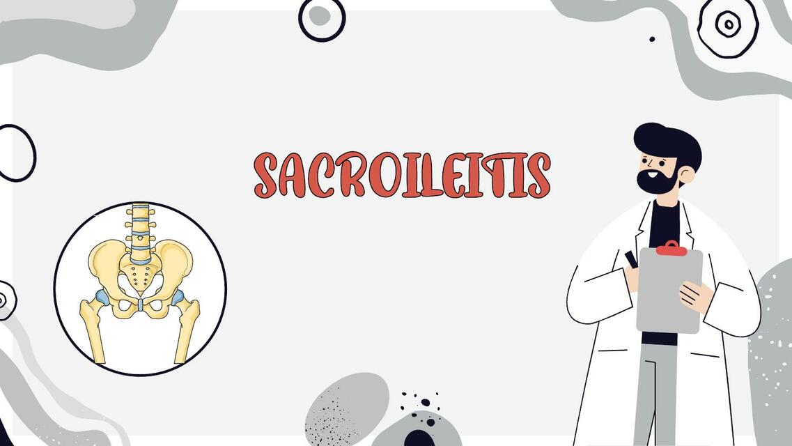 Sacroileitis