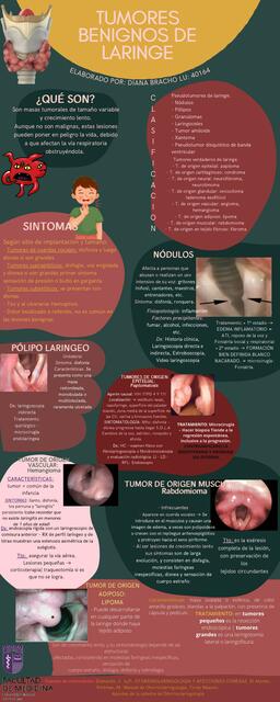 Infografia tumores benignos de laringe 