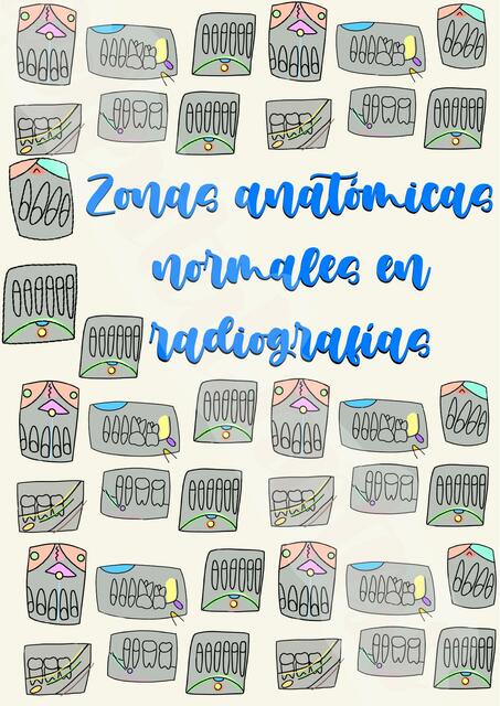 Zonas anatómicas normales en radiografías