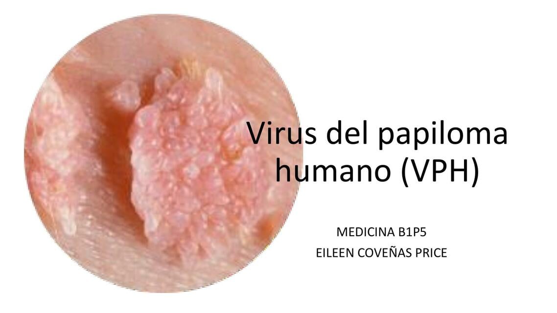 Virus Del Papiloma Humano VPH virus-del-papiloma-humano-vph