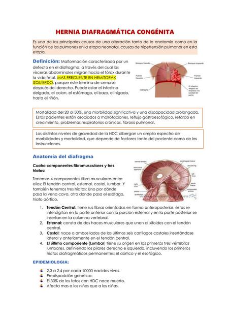 Hernia Diafragmática Congénita