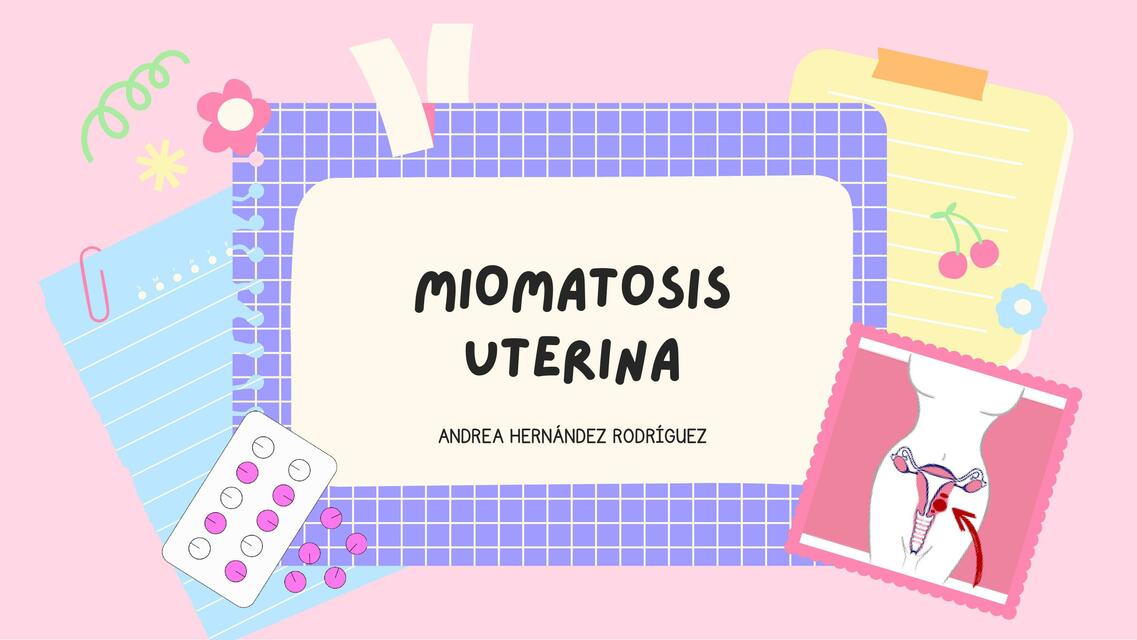 Miomatosis Uterina 