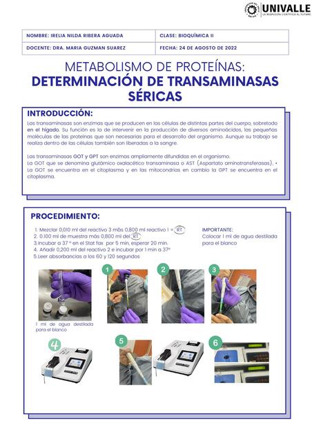 Determinación de Transaminasas Séricas