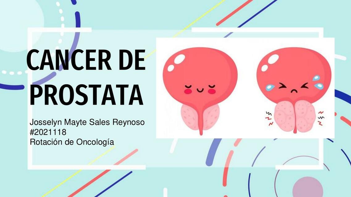 Cáncer de Próstata