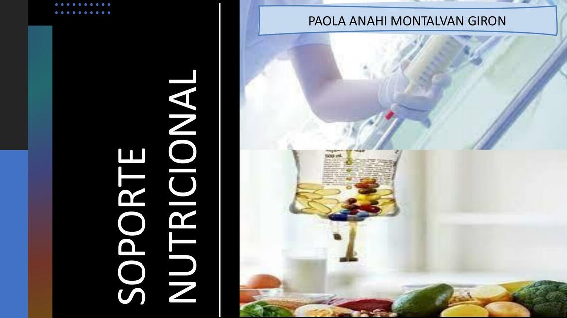 Soporte Nutricional Enteral y parenteral