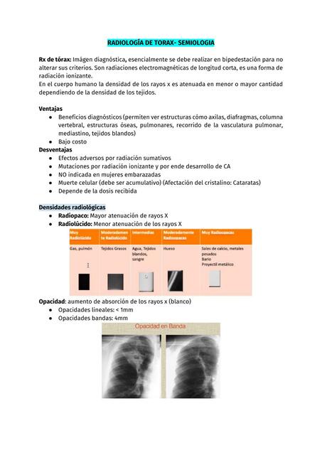 Radiología de Tórax- Semiología 