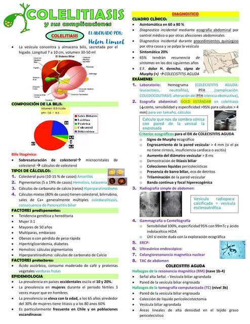 Colelitiasis y sus Complicaciones 