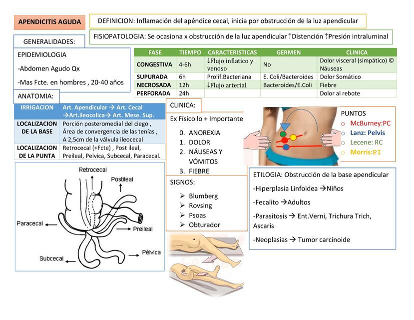 Apendicitis 