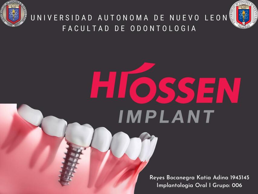 Implantes Dentales 