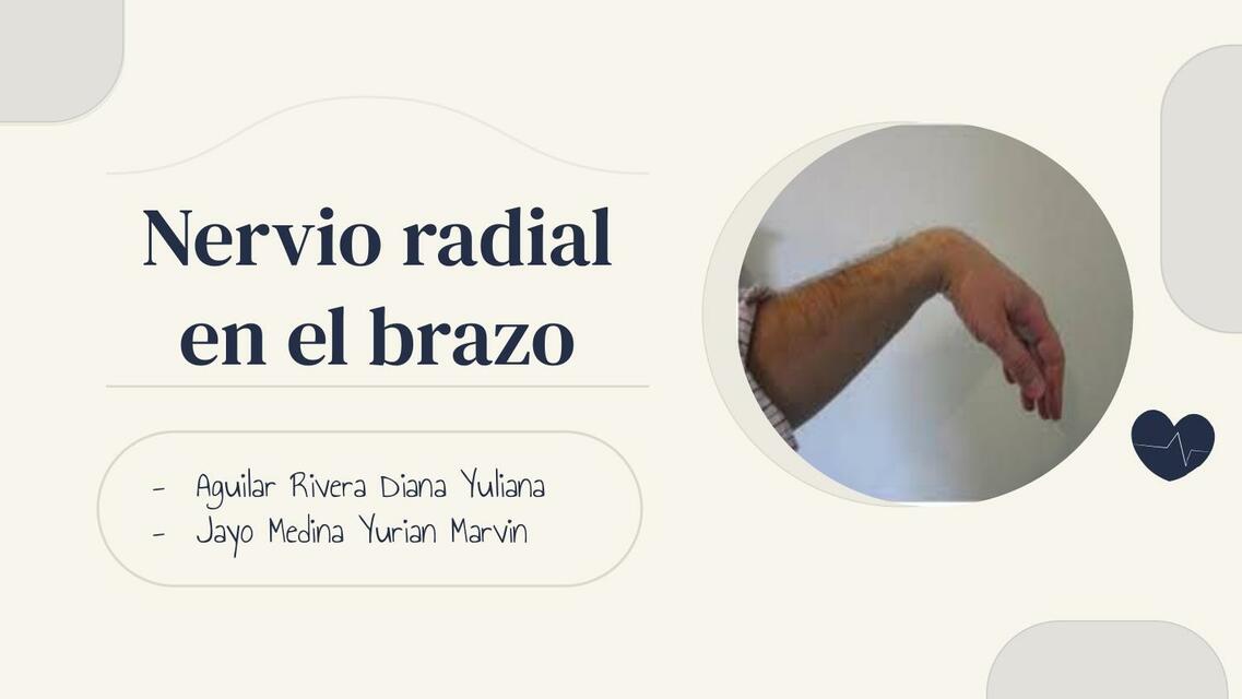 Lesión en Nervio Radial del Brazo