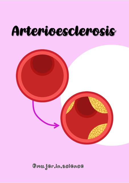 Arterioesclerosis