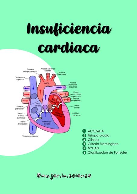 Insuficiencia cardiaca