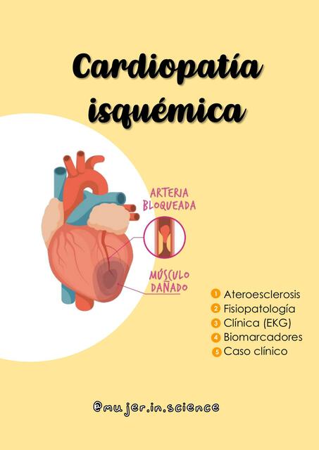 Cardiopatía isquémica