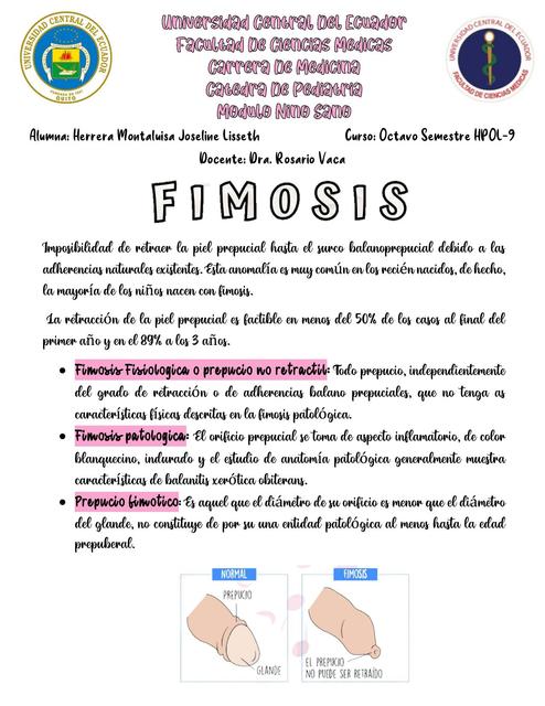 Fimosis