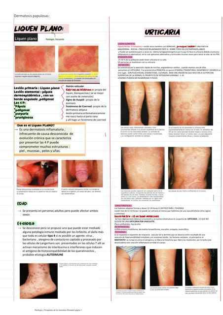 Dermatosis Papulosas (Urticaria -Liquen Plano)