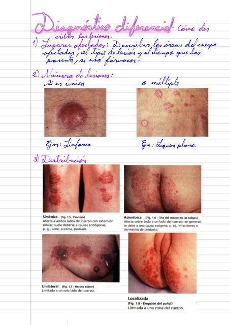 Diagnóstico diferencial 