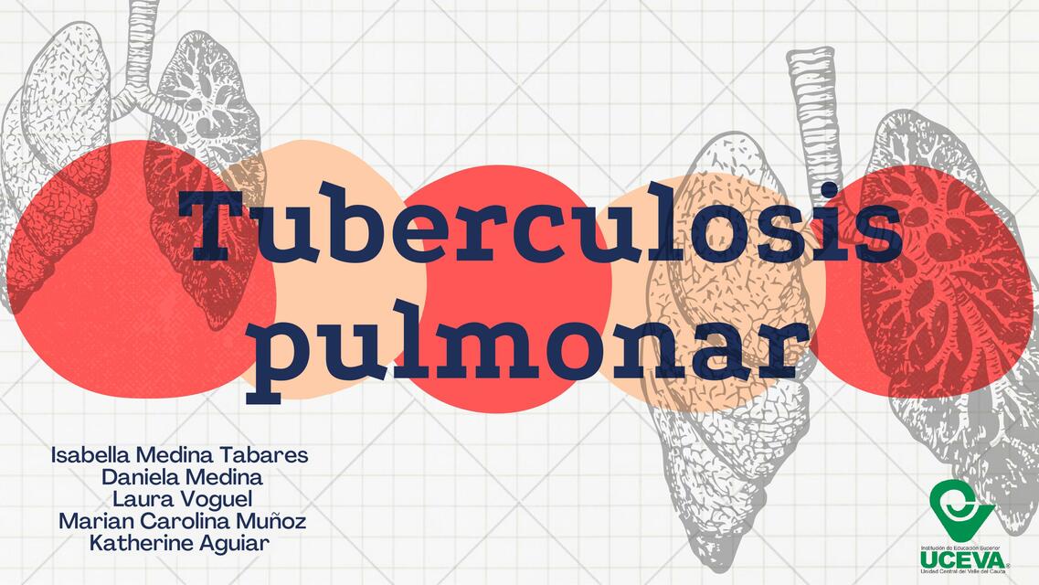 Tuberculosis pulmonar 