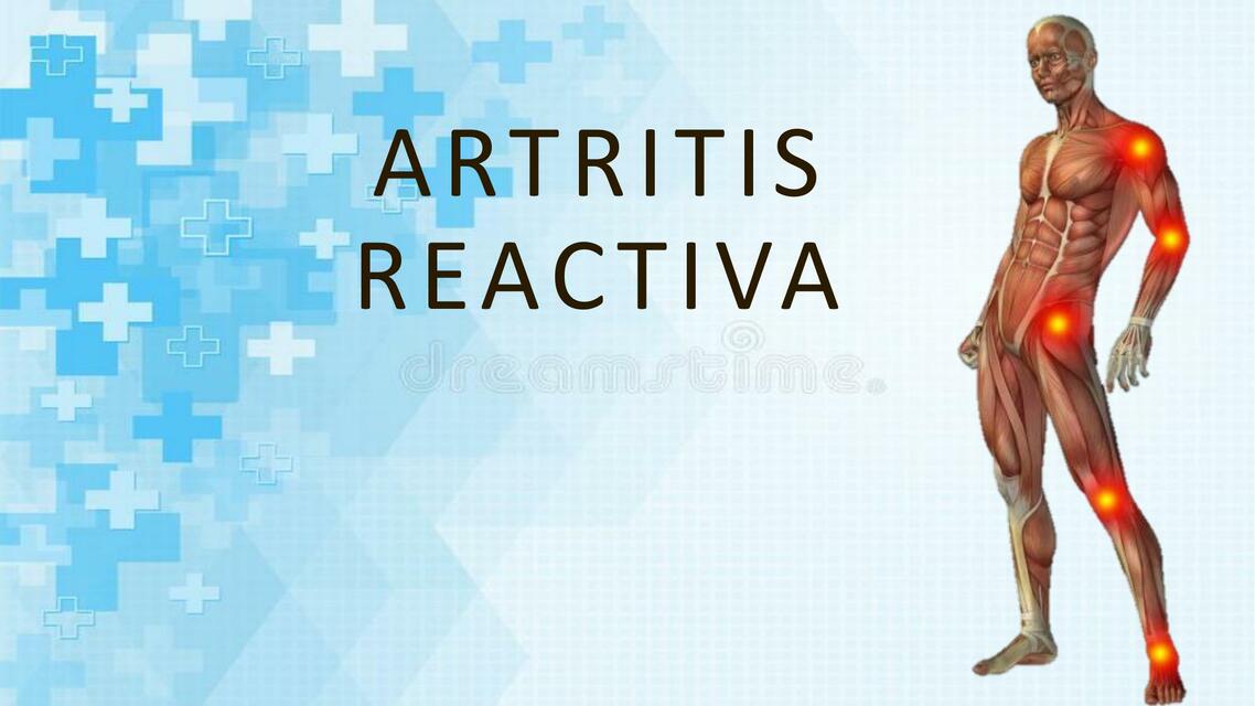 Artritis reactiva 