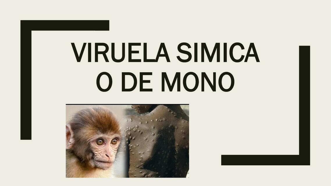 Viruela del mono