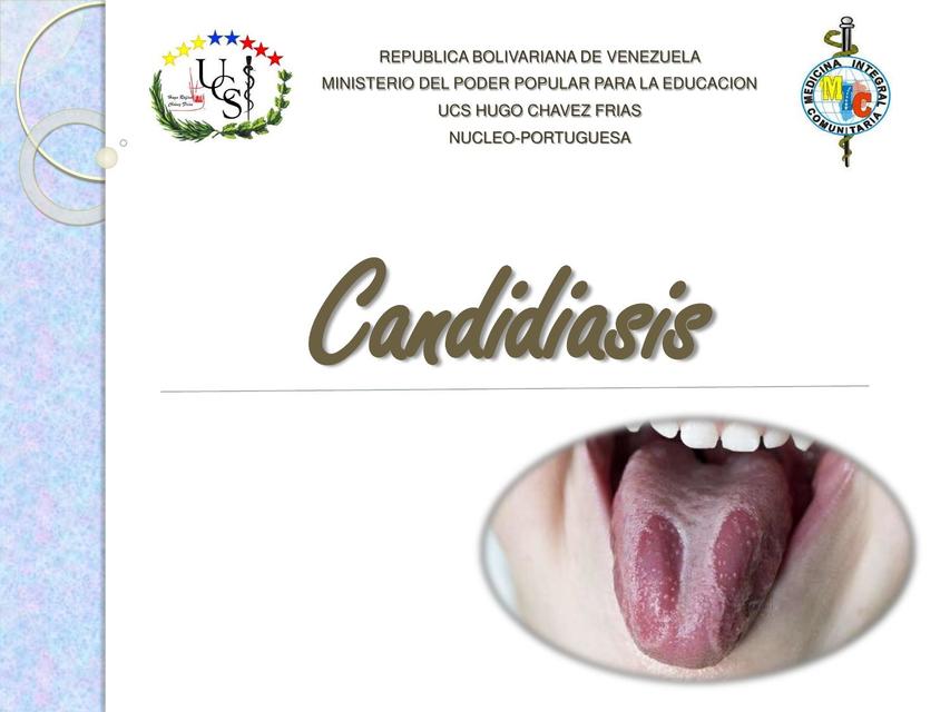 Candidiasis 