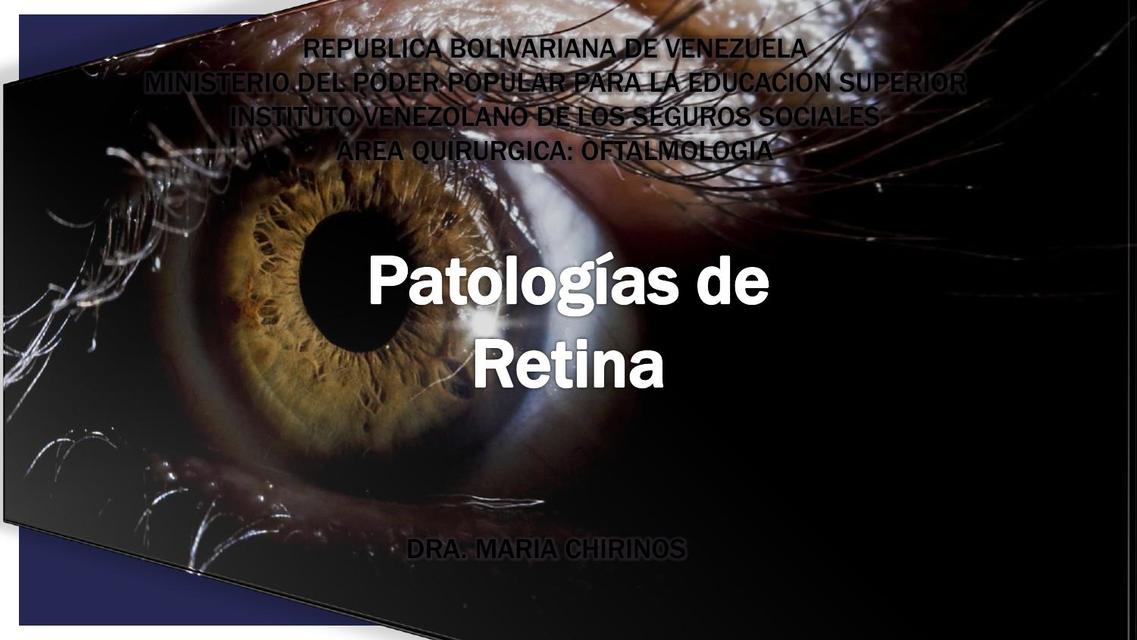 Patologias de retina