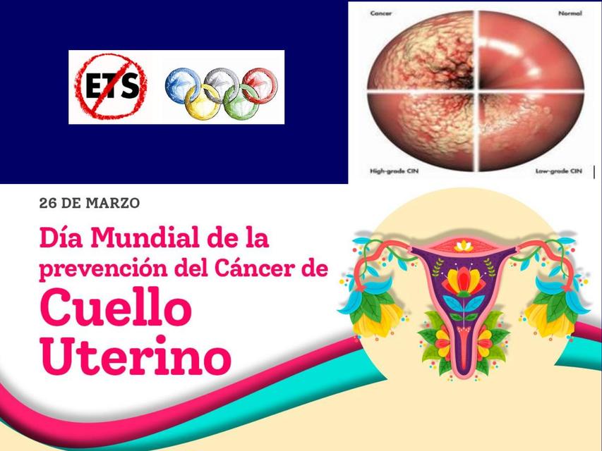 CANCER DE CUELLL UTERINO_ ginecología