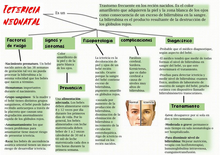 Ictericia neonatal