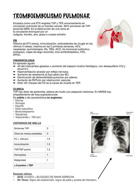 TEP - Tromboembolismo pulmonar