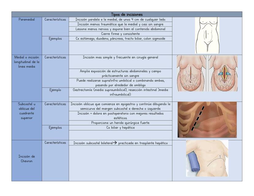 Tabla tipos de incisiones quirúrgicas 