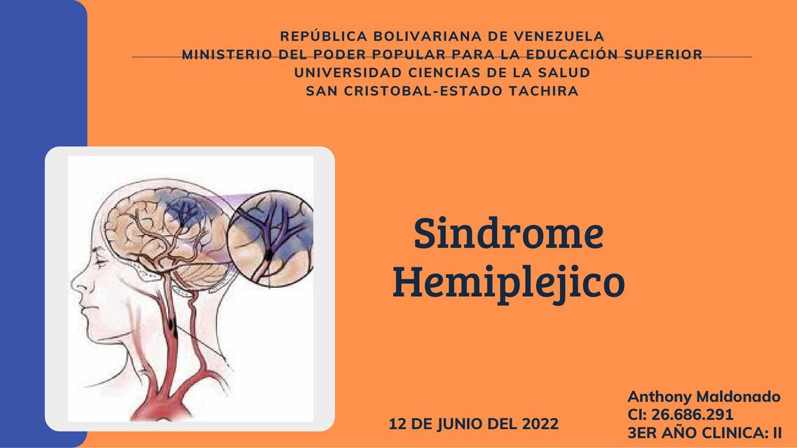 Síndrome Hemipléjico